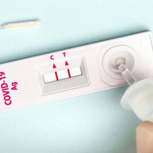 20 בדיקות אנטיגן בתיות מהירות לזיהוי קורונה מחברת Life Gene